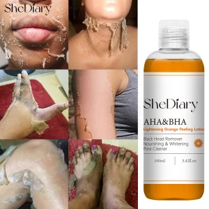 Zhenyan 100ml Orange Peeling Lotion OEM ODM Body Lotion for Exfoliating Blackheads Nourishing and Brightening Skin