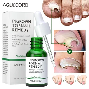Private Label Nail Repair Oil
