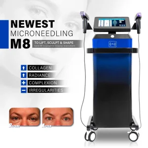 Vivace RF Microneedling