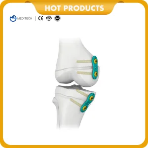 Orthopedic Implant Titanium Compression Locking Plate Pediatric Eight-Plate Guided Growth