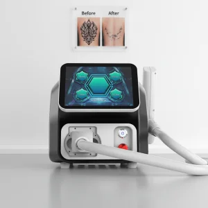 Picosecond NdYAG Laser for Removing Dark Spots and Anti-Freckles