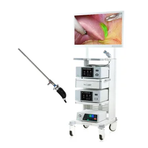 Advanced 4K UHD Medical Endoscope System for Arthroscopy