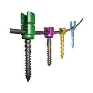 Spine Fixation Surgery