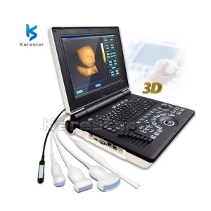 Ultrasonido 4D portátil