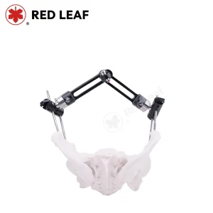 Pelvic Fracture Fixator