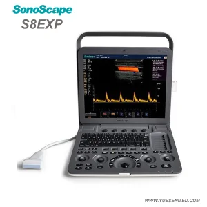 Medical Equipment Hospital Sonoscape S8exp Portable Cardiac Color Doppler Ultrasound Machine