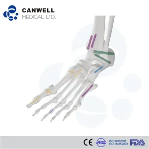 Herbert Headless Screws