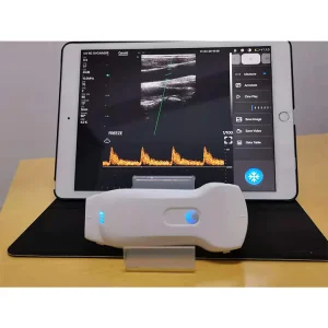 Slovakia Portable Ultrasound