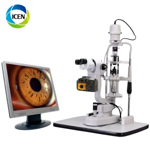 Digital Slit Lamp