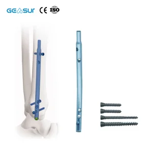 Geasure Retrograde Tibial Intramedullary Nail Instrument Set-Orthopedic Surgical Kit for Tibial Fracture Fixation Hospital Use