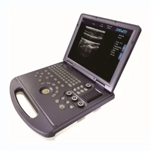 Laptop Ultrasound Device