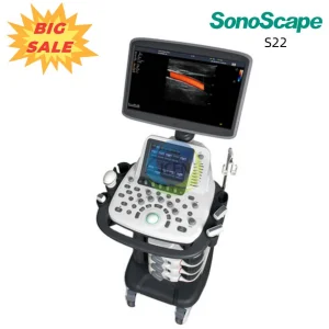 Sonoscape S22 Carro Hospitalario 2D Escáner Ultrasónico Doppler Color Máquina de Ultrasonido Doppler Color Obstétrico