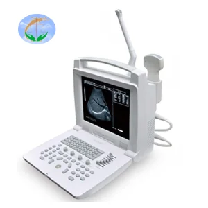 Factory Direct Sales Black and White Digital Ultrasonic Imaging System