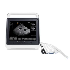 My-A012-N Touch Screen Black and White Portable Veterinary Medical Ultrasound Instruments