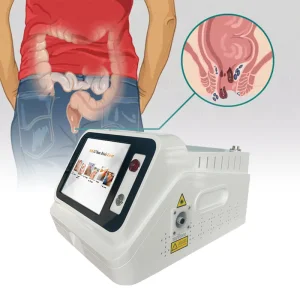 Hemorrhoid Treatment Laser Device