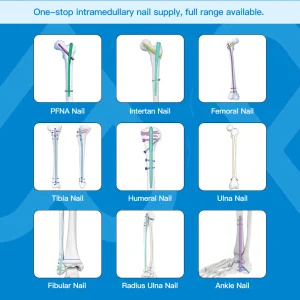 Intertan Intramedullary Nail Titanium Alloy CE Certified Class III Minimally Invasive Surgery Instrument Set Precision Aiming