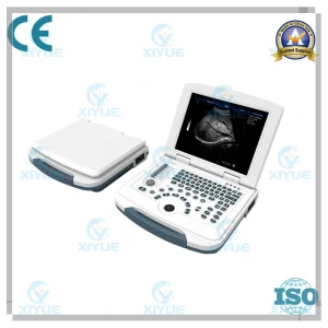 Sistema de Diagnóstico Ultrasonido Digital Completo para Laptop Cy-580