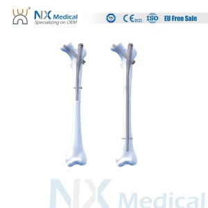 Proximal Femoral Nail