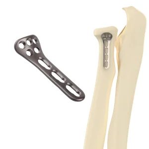 CANWELL Proximal Radius Locking Plate 2.4
