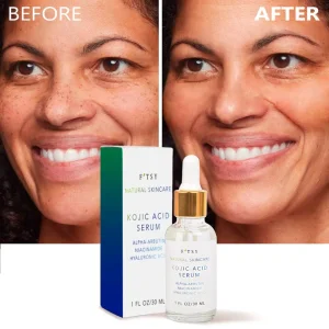Factory Wholesale Organic Whitening Kojic Acid Serum