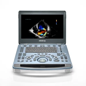Máquina de Diagnóstico Mindray M8 Sistema de Ultrasonido Trolley Doppler Color Digital Completo Médico a Pantalla Completa Ultrasonido 15inch
