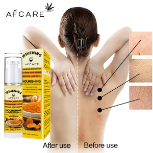 Turmeric Body Lotion