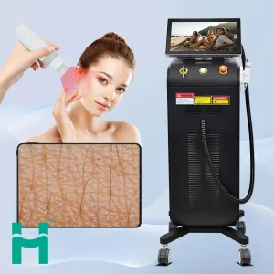 Factory Supply Laser