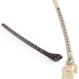 Proximal Femoral Serpentine Plate Korea