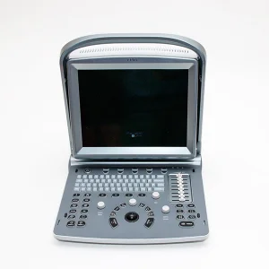Chison Eco5