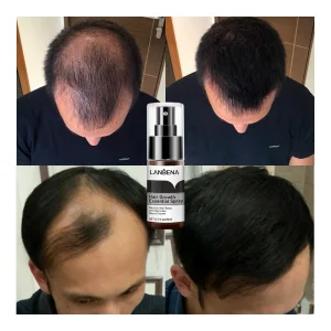 LANBENA Herbal Instant Hair Grow Spray Hair Treatment Growth Women Wholesale