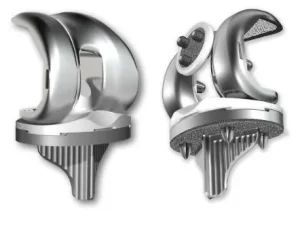 Just Medical Orthopedic Implant Skii Complex Primary Total Knee Replacement