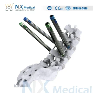 Nx Medical Sf-IV Mis Cannulated Bone Cement Spinal Pedicle Screw 5.5mm System