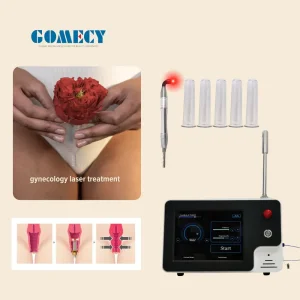Rejuvenecimiento Vaginal con Láser