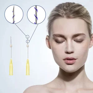 All Types of Korea Pdo Threads Hilos De Pdo Cog Face and Body Lift V Line Medical Suture Absorbable Suture Product