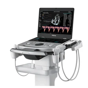 Sistema de ultrasonido médico de la serie ME de Mindray para imágenes cardíacas, abdominales y vasculares humanas