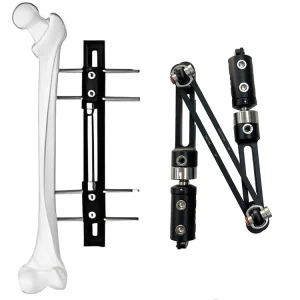 Knee Joint Fixator