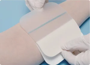 High Absorbent Hydrocolloid Foam Dressing Wound Care Dressing