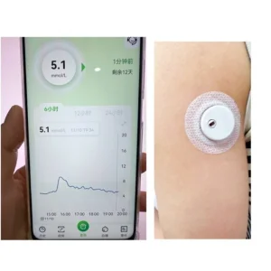 Dispositivo de monitoreo de glucosa digital inteligente portátil no invasivo en tiempo real y con precisión médica