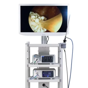 Gtk Medical UHD Digital Colposcope Video Colposcope Gynecology Instruments Camera System