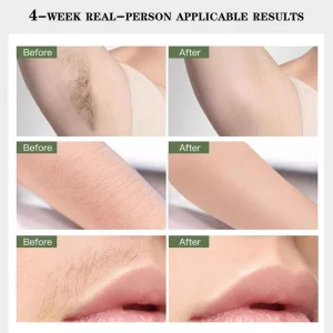 Professional Home Use High Power Laser IPL Epilator