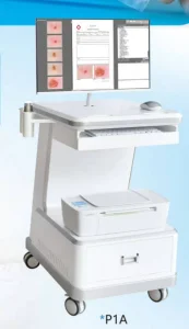 Smart Dermatoscope with Mobile Connectivity and Analysis Tools