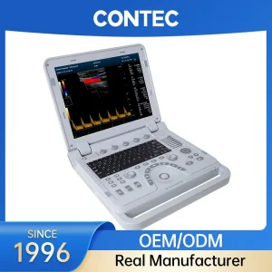 Contec Portable Ultrasound
