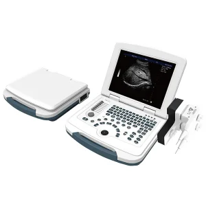 Ubw580 Escáner de diagnóstico digital de embarazo médico portátil de laptop, máquina de ultrasonido humana en blanco y negro