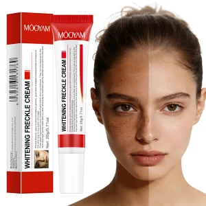 Strong Effective Whitening Freckle Cream