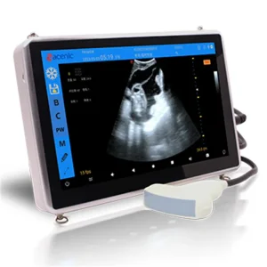 Color Doppler Ultrasound
