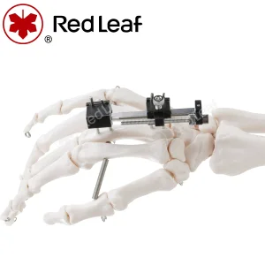 Mini Palm Fracture Compression Extension Finger Fixator