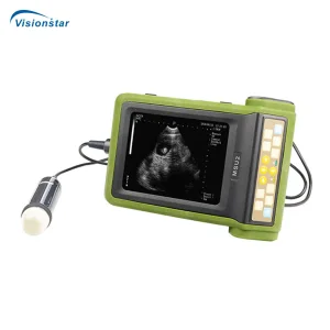 Msu-2 Full Digital Mechanical Sector Ultrasonic Diagnostic Instrument (Veterinary)