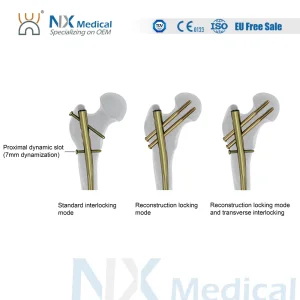 Nx Medical Nail