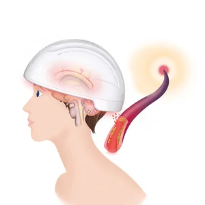 Brain Neuron Feedback Stimulation Helmet