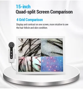 50X 200X AI Scalp Analyzer